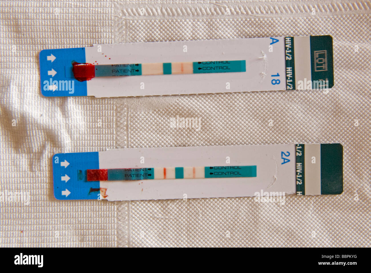 HIV RAPD TESTS HIV RAPD TESTS